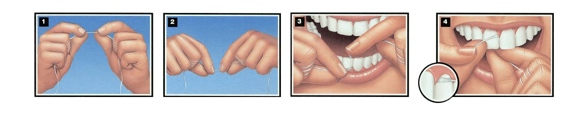 Στοματική υγιεινή για τα δόντια